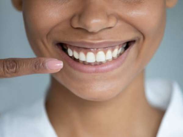 ¿Sabes cuáles son los cinco estándares principales para la salud dental?